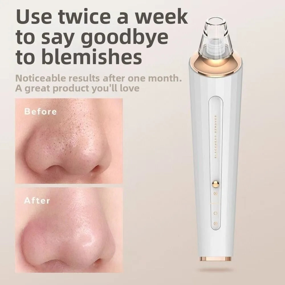 Adjustable Power Electric Pore Cleaning Non Damaging Pores Electric Suction Blackhead Remover Rechargeable Face Cleaning