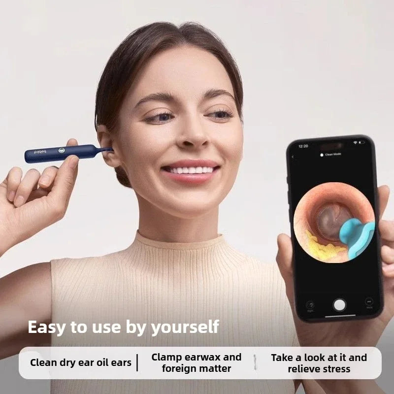 Xiaomi Bebird Visual Ear Cleaner HD Clipable Tweezers Ear Picker Wireless Cleaning Endoscope Home Visual Ear Scoop with Camera